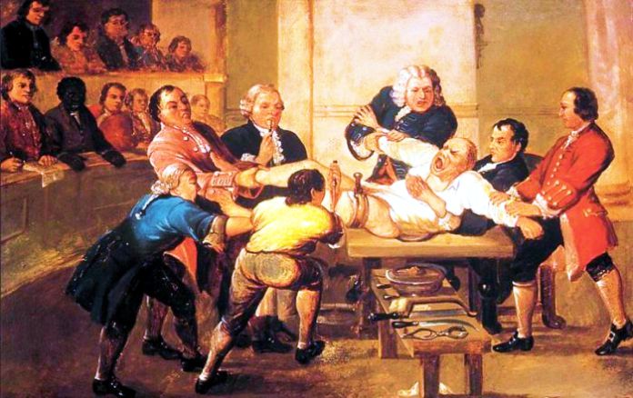 Cómo realizaban los médicos la cirugías antes de la anestesia moderna