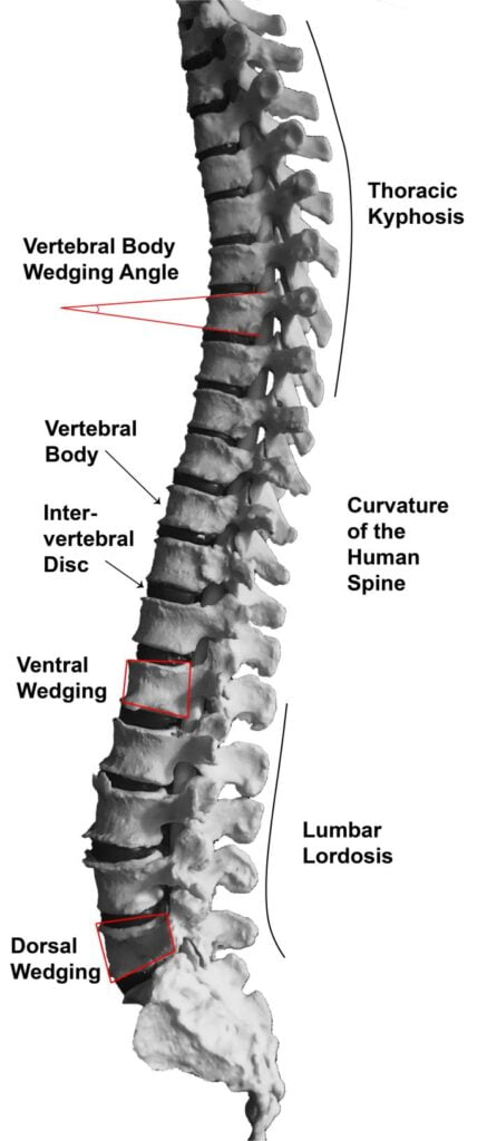 Curvaturas de la columna vertebral